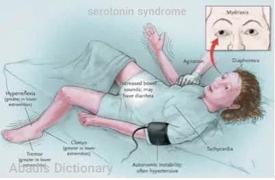 serotonin syndrome